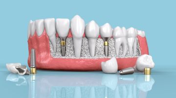 best dental courses in delhi