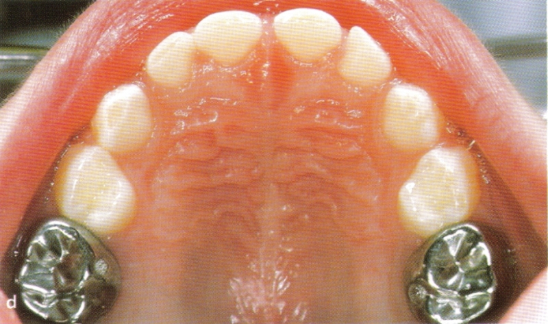 paediatric dentistry